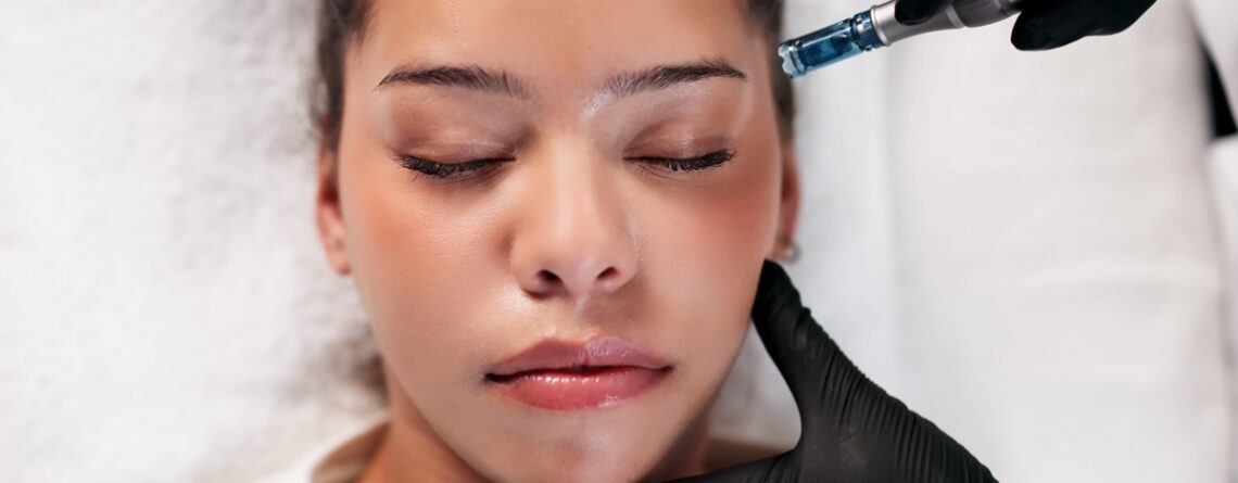 microneedling cost long island