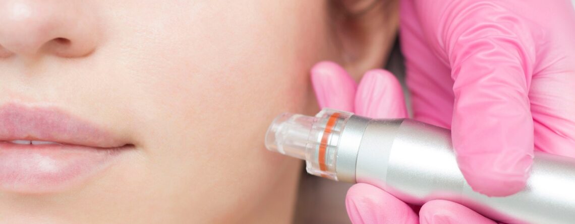HydraFacial vs. Microneedling