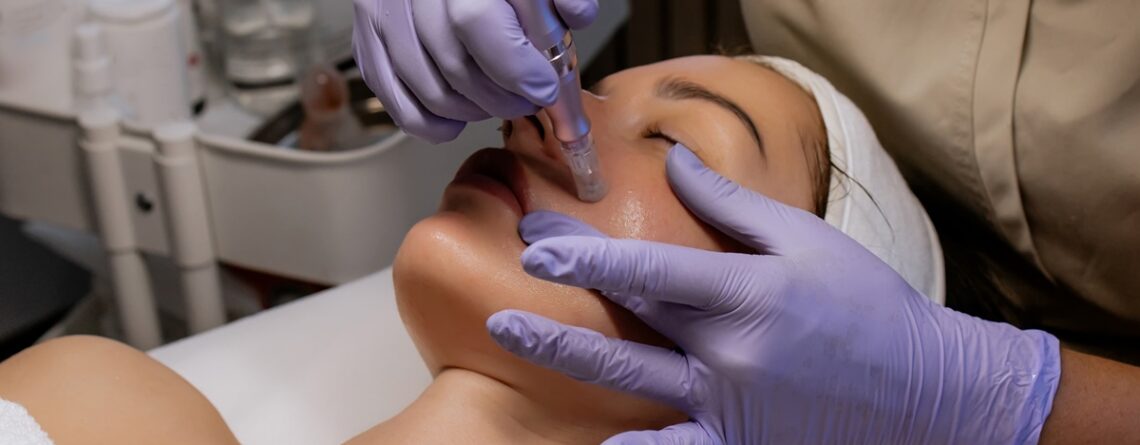 what is microneedling
