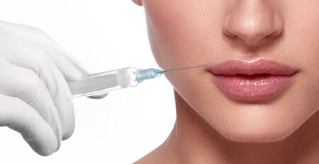Juvederm vs. Restylane
