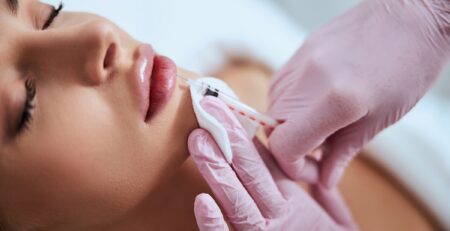 Comparison of lip flip and lip filler results at a Long Island med spa